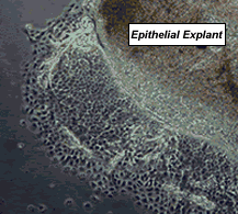 (Image: 2 Day old culture of epithelial cells)