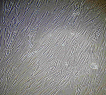 (Image: 11 Day-old fibroblast culture)