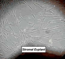 (Image: 7 Day old culture of fibroblast cells)